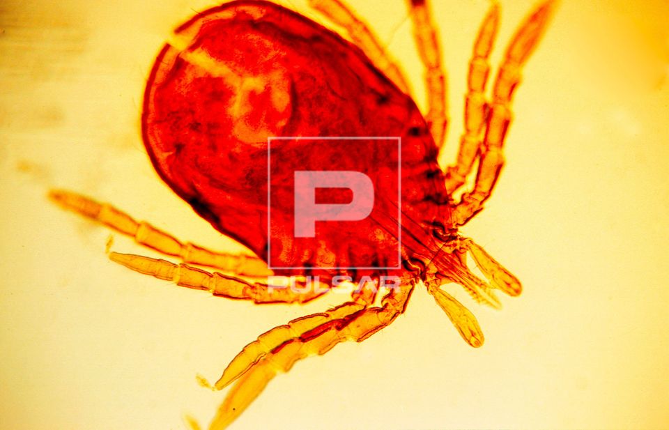Carrapato - transmissor de várias doenças entre elas - doença de Lyme ou borreliose de Lyme - magnificaçã