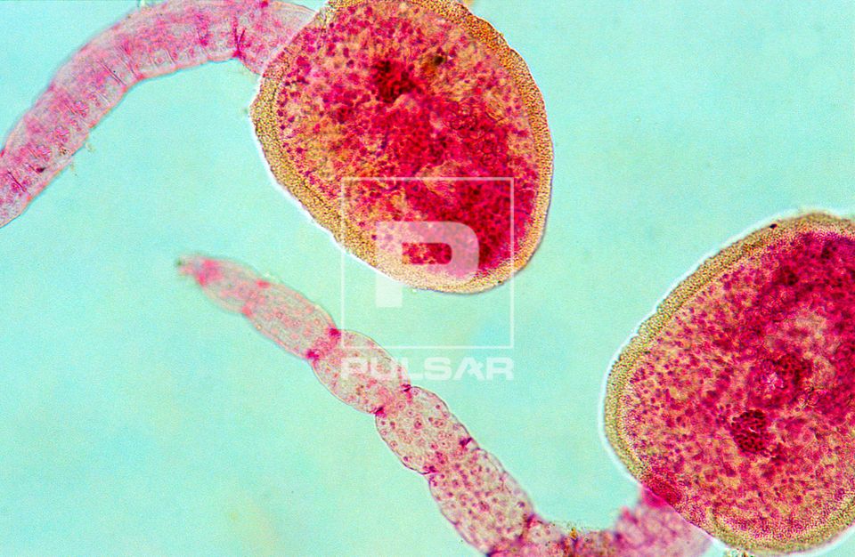 Cercária - forma larval de parasita trematódeo - Fasciola hepatica - magnificação 200 vezes