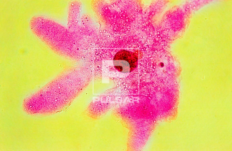 Ameba - Amoeba proteus - protozoário de vida livre - organismo unicelular - magnificação 400 vezes