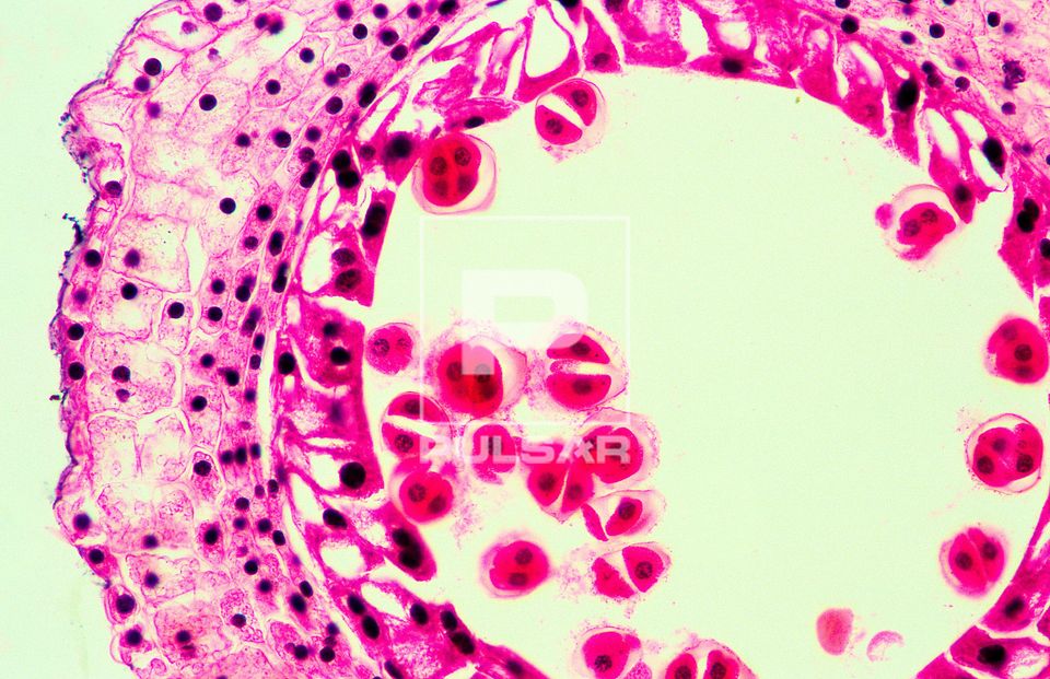 Meiose em antera de Lírio - magnificação 200 vezes