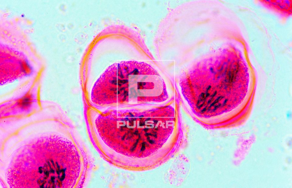 Meiose em antera de Lírio - Prófase II - aumento  1000 vezes