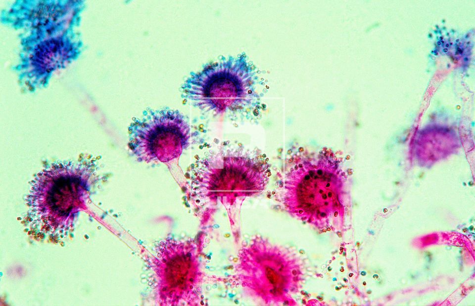 Aspergillus sp - fungos decompositores de alimentos - esporos e ascocarpo - magnitude 400 vezes