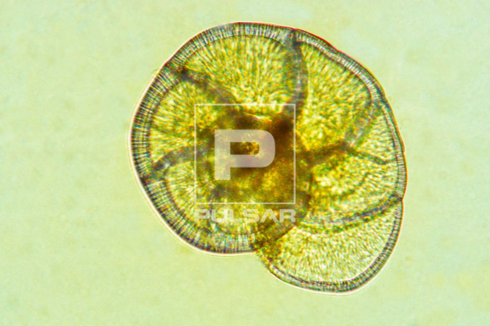 Foraminífero - organismo unicelular - Foraminifera - magnificação 200 vezes