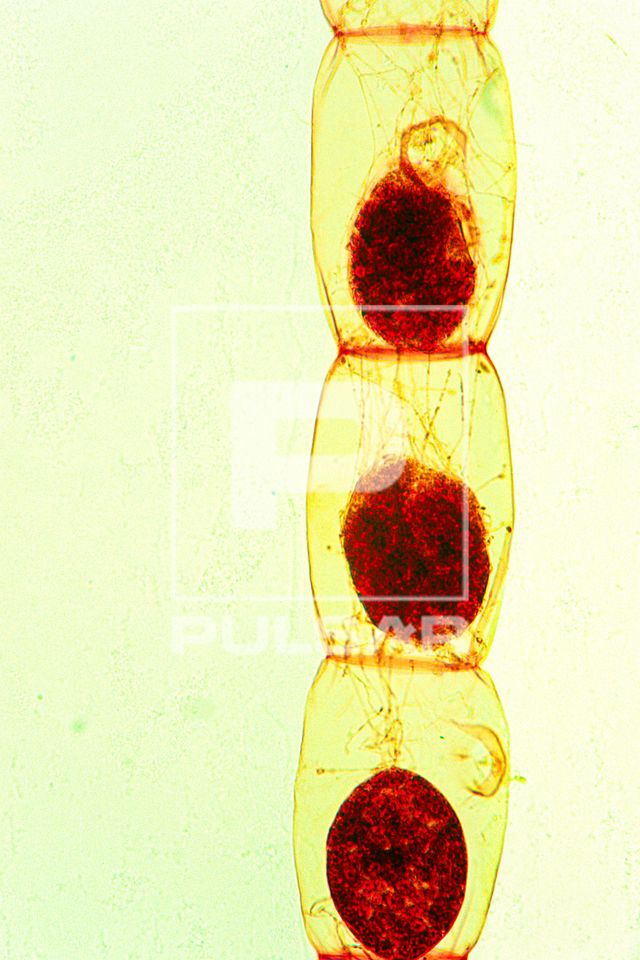 Conjungação em Spirogyra - final da passagem de células de um filamento para outro - 2 de 2 - reprodução 