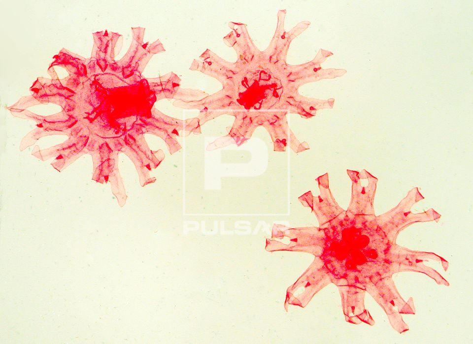 Imaturos de medusa - caravela - microscópio ótico - magnificação 50 vezes
