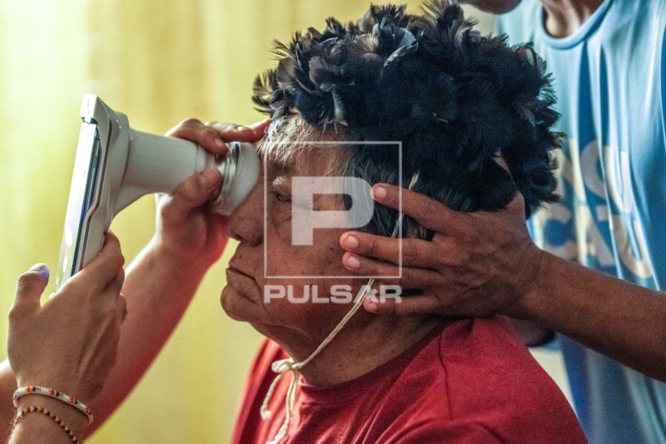 Exame oftalmológico em indígena da Aldeia Ipatsé da Etnia Kuikuro - Parque Indígena do Xingu