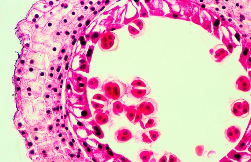 Meiose em antera de Lírio - magnificação 200 vezes