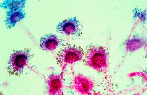 Aspergillus sp - fungos decompositores de alimentos - esporos e ascocarpo - magnitude 400 vezes