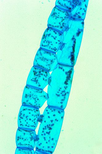 Espirogira - Alga verde filamentosa - Spirogyra sp - magnificação 200 vezes