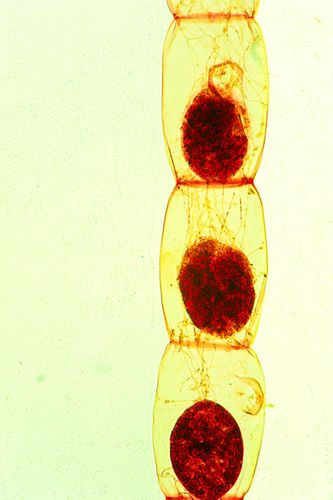 Conjungação em Spirogyra - final da passagem de células de um filamento para outro - 2 de 2 - reprodução 