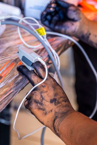 Uso de oxímetro de dedo para medir oxigenação do sangue - Aldeia Ipatsé - etnia Kuikuro - Parque Indígena
